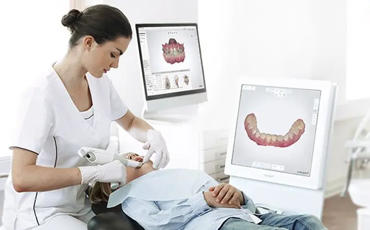 tecnología 3shape, escaner intraoral