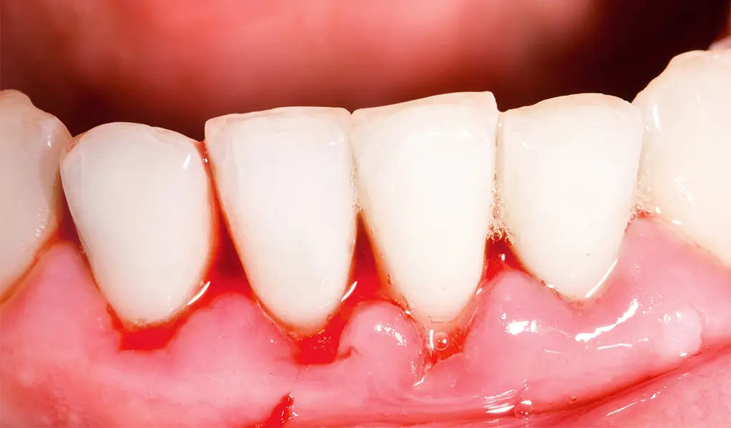 imagen de Periodoncia